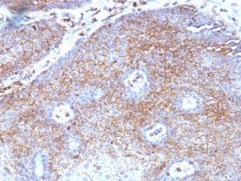 B2M / Beta 2 Microglobulin Antibody (clone B2M/1118)