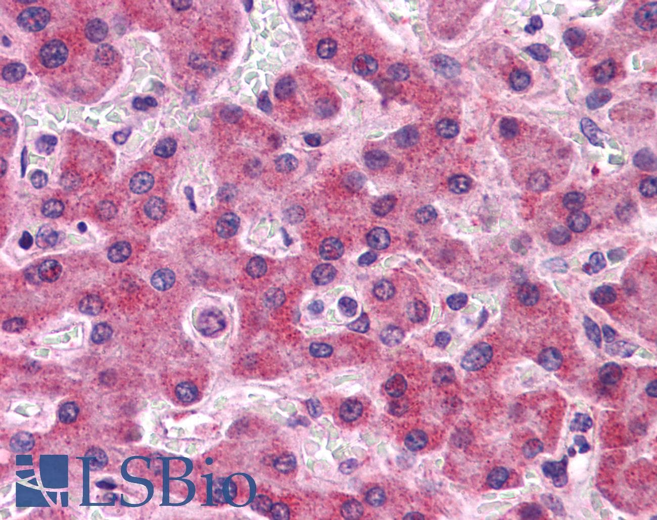 IHC-plus™ Polyclonal Rabbit anti-Human SIPA1L2 Antibody (IHC, IF, WB)