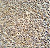 Polyclonal Rabbit anti-Human ZNF180 Antibody (aa103-132, IHC, WB)