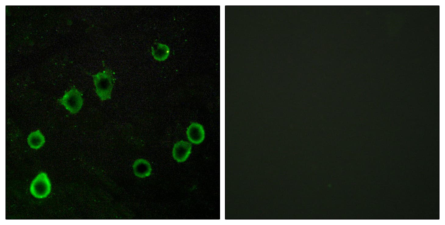 Polyclonal Rabbit anti-Human ADORA2A/Adenosine A2A Receptor Antibody (aa321-370, IHC, IF, WB)