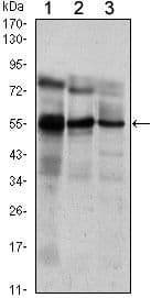 Monoclonal Mouse anti-Human ETV5 / ERM Antibody (clone 3H3, WB)