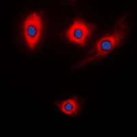 Polyclonal Rabbit anti-Human KALRN / KALIRIN Antibody (Internal, IHC, IF, WB)