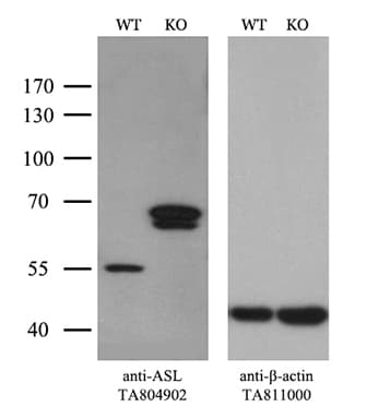 ASL / Argininosuccinate Lyase Antibody (clone OTI9G2, Carrier-free)