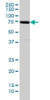 SNX1 Antibody (clone 6H1)