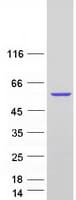 Human PDP1 Protein (Recombinant Myc-DDK (Flag))