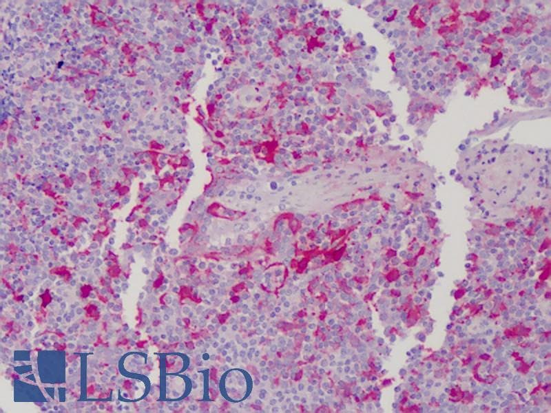 IHC-plus™ GSN / Gelsolin Antibody