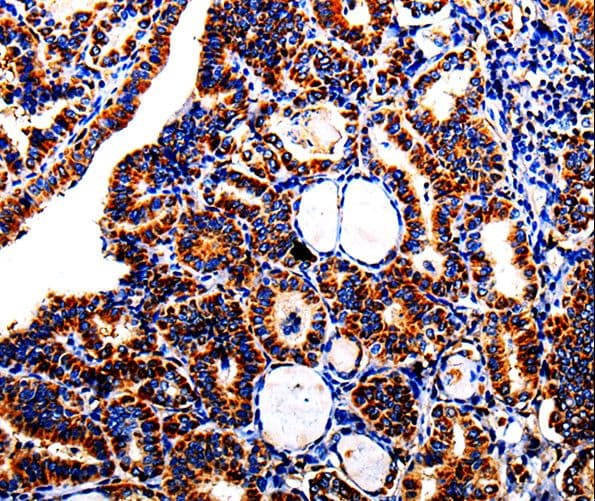 Alpha-Fetoprotein Antibody