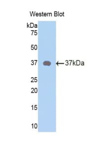 Neuropeptide Y / NPY Antibody (aa31-98, PE)