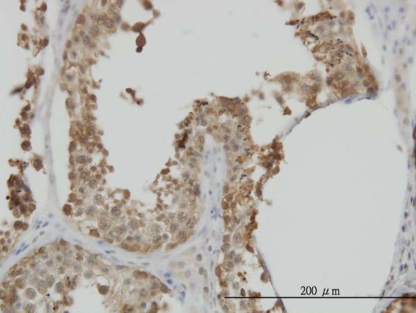 HSPA1L Antibody (clone 7H6)