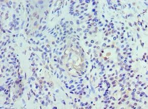 UBC6 / UBE2J2 Antibody (aa1-230)