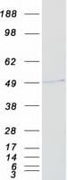 Human RING1 Protein (Recombinant Myc-DDK (Flag))