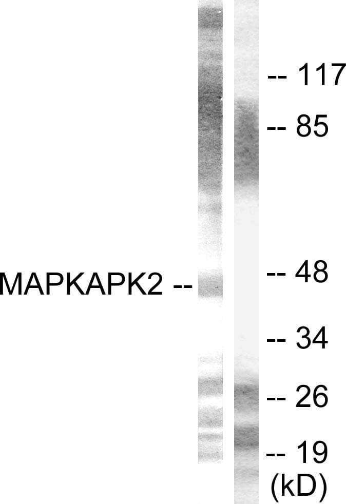 MAPKAPK2 / MAPKAP Kinase 2 Antibody (p334)