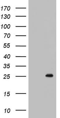 BCL2 / Bcl-2 Antibody (clone OTI1E9)