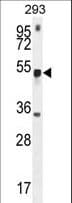Polyclonal Rabbit anti-Human METTL4 Antibody (aa315-344, IHC, WB)