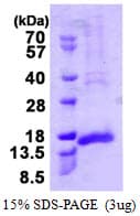 Human CENPH / CENP-H Protein (Recombinant His)