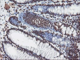 NONO / P54NRB Antibody (clone OTI2C9)