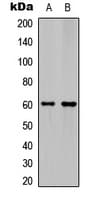 Polyclonal Rabbit anti-Human Ephrin B1+B2 Antibody (C-Terminus, WB)