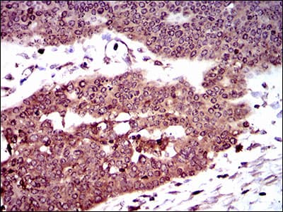 Monoclonal Mouse anti-Human DCTN4 / Dynactin 4 Antibody (clone 3G9D7, aa57-298, IHC, IF, WB)