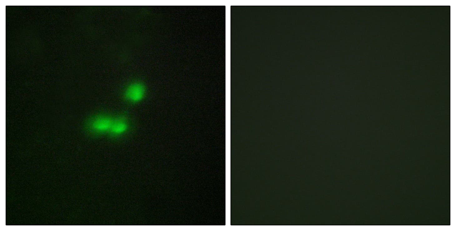 Polyclonal Rabbit anti-Human BRF1 Antibody (aa231-280, IHC, IF, WB)