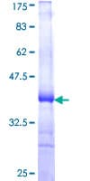 Human KLK5 / Kallikrein 5 Protein (Recombinant GST, N-terminus)