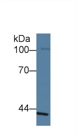 SLFN12L Antibody (aa658-891)