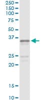 Monoclonal Mouse anti-Human SGCG / Gamma-Sarcoglycan Antibody (clone 3C5, WB)