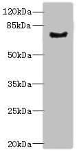 IHC-plus™ Polyclonal Rabbit anti-Human LRRN3 Antibody (IHC, WB)