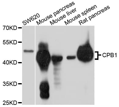 IHC-plus™ CPB / Carboxypeptidase B Antibody