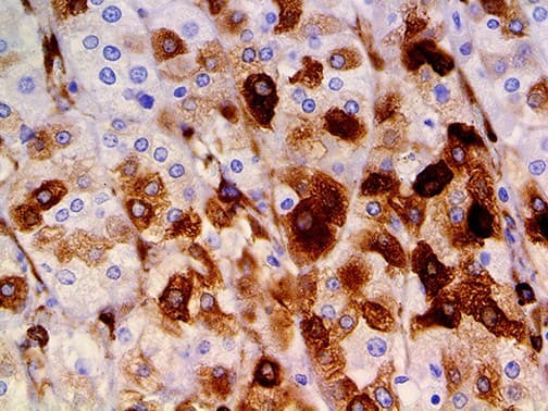 Osteonectin / SPARC Antibody