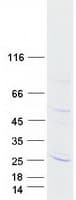 Human TMEM126A Protein (Recombinant Myc-DDK (Flag))