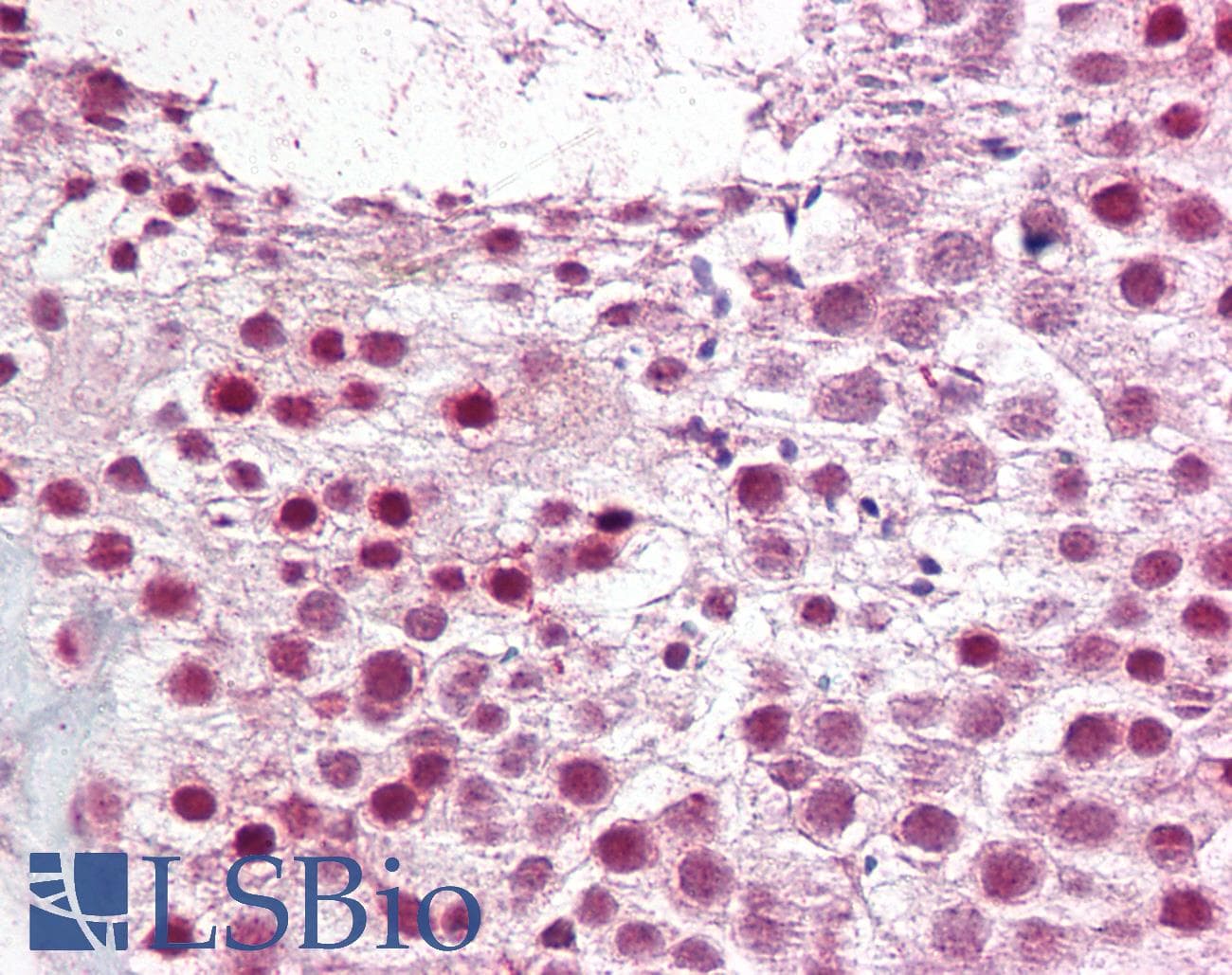 IHC-plus™ Polyclonal Rabbit anti-Human SUMO2 + SUMO3 Antibody (IHC, WB)