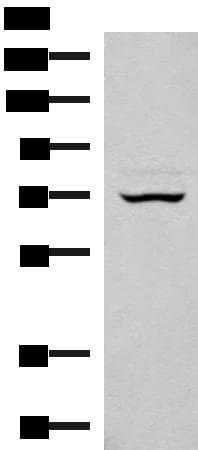 EIF2AK1 Antibody