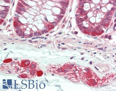 IHC-plus™ Polyclonal Rabbit anti-Human BICD1 Antibody (aa300-350, IHC)