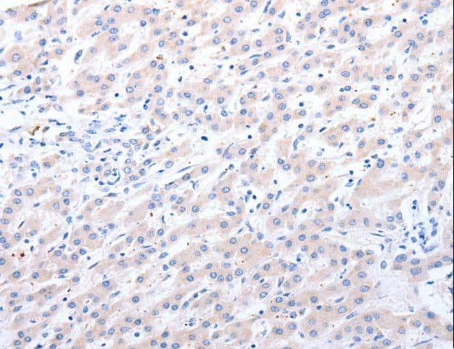 Polyclonal Rabbit anti-Human ALDH1A1 + ALDH1A2 + ALDH1A3 Antibody (IHC, WB)