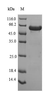 Human PEX19 Protein (Recombinant 10His-SUMO, N-terminus)