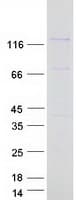 Human PPP6R3 / SAPS3 Protein (Recombinant Myc-DDK (Flag))