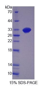 Mouse GDF11 / GDF-11 Protein (Recombinant)