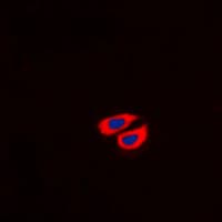 COL6A2 / Collagen VI Alpha 2 Antibody (Internal)