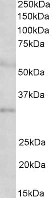 IHC-plus™ IGFBP1 Antibody (aa156-170)