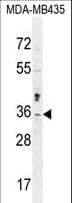 Polyclonal Rabbit anti-Human MTX2 Antibody (aa232-261, IHC, WB)