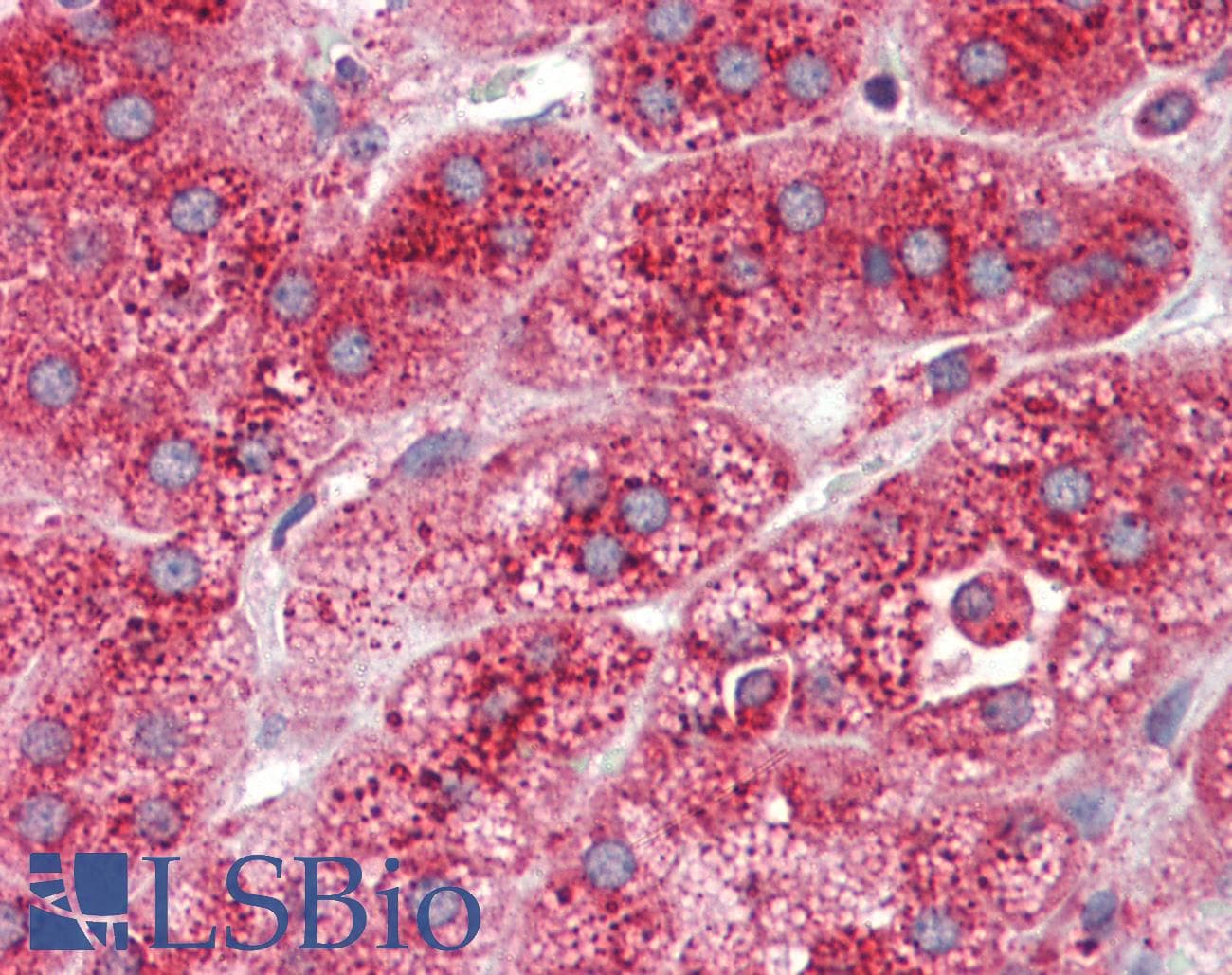 IHC-plus™ Polyclonal Rabbit anti-Human ASAH1 / Acid Ceramidase Antibody (IHC, IF, WB)