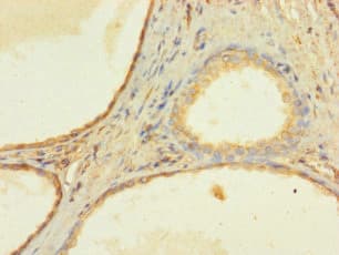 ZNF432 Antibody