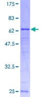 Human YKL39 / CHI3L2 Protein (Recombinant GST)