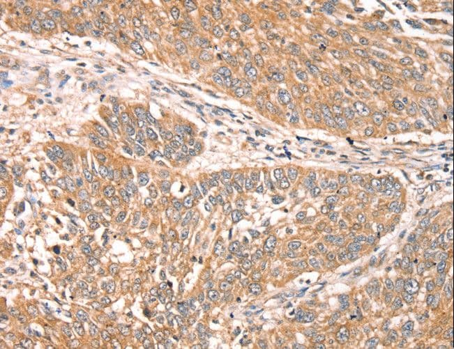 RPS6KA1 / RSK1 Antibody