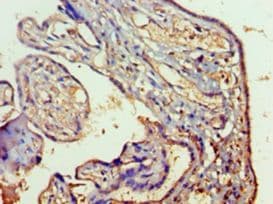 RAB5A / RAB5 Antibody (aa1-215)