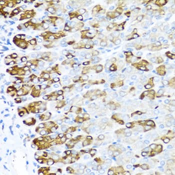 IHC-plus™ MGP / Matrix Gla-Protein Antibody