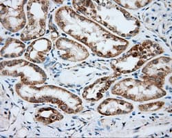 Monoclonal Mouse anti-Human SRR / Serine Racemase Antibody (clone OTI5G3, IHC, IF, WB)
