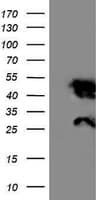 IHC-plus™ NNMT Antibody (clone 3D8)