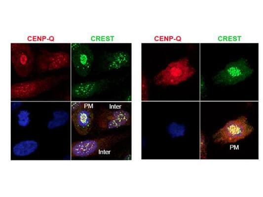 Polyclonal Rabbit anti-Human CENPQ Antibody (IF, WB)