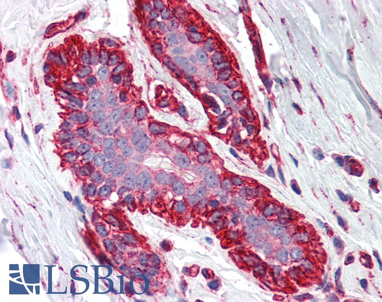 IHC-plus™ Polyclonal Rabbit anti-Human GGA3 Antibody (IHC, WB)